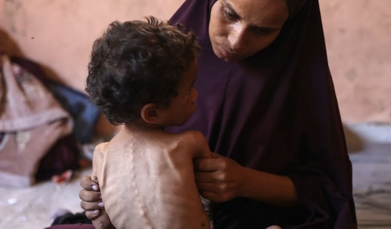 Abluka altındaki Gazze’de açlıktan ölenlerin sayısı yükseliyor