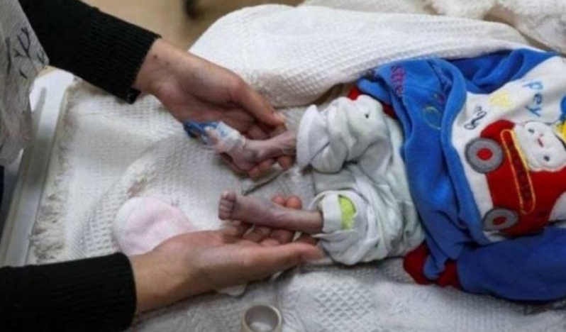 BM: Gazze’de çadırlar yetmiyor, çocuklar soğuktan ölüyor