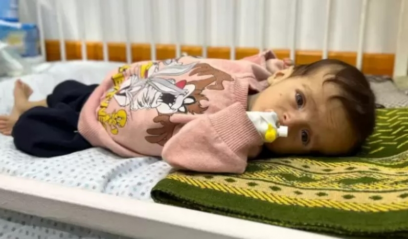Gazze’de gıda krizi: Çocuklar için ‘tehlikeli döngü’ uyarısı